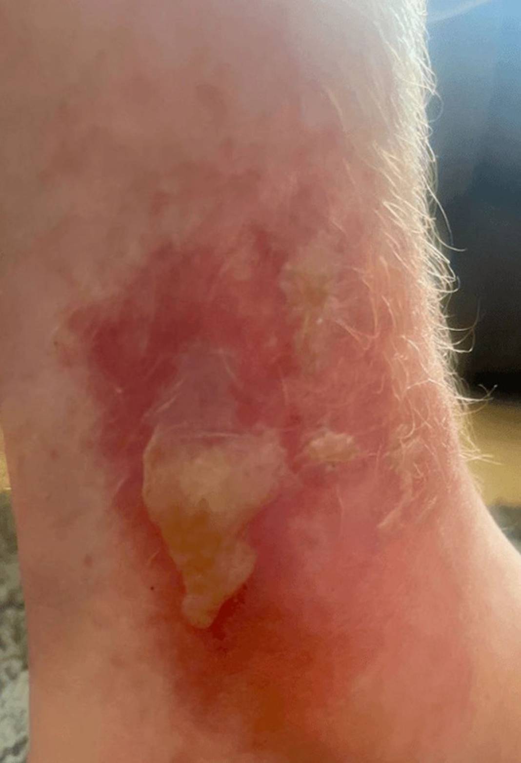 Bu otun sadece yanından geçti, hayatı karardı! Bir ömür onunla yaşayacak, kabus gibi 5